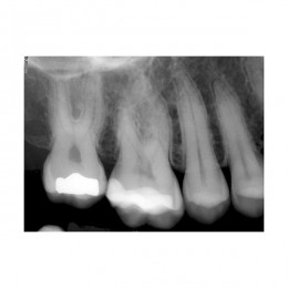 SuniRay2 - система компьютерной радиовизиографии