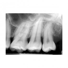 SuniRay2 - система компьютерной радиовизиографии