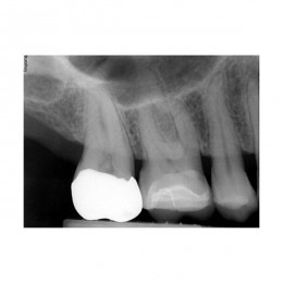 SuniRay2 - система компьютерной радиовизиографии