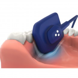 EzSensor Soft - цифровой радиовизиограф