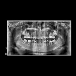 Pax-i - цифровой панорамный аппарат, без цефалостата