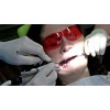 Anesto RA-5 - система внутрикостной анестезии | W&H DentalWerk (Австрия)