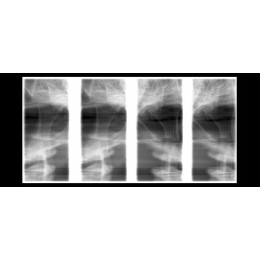 Planmeca ProOne - универсальный цифровой ортопантомограф