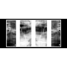 Planmeca ProOne - универсальный цифровой ортопантомограф