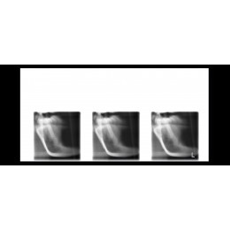 Planmeca ProOne - универсальный цифровой ортопантомограф