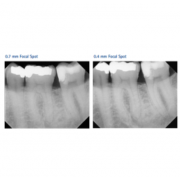 Gendex Expert DC - высокочастотный настенный рентгеновский аппарат